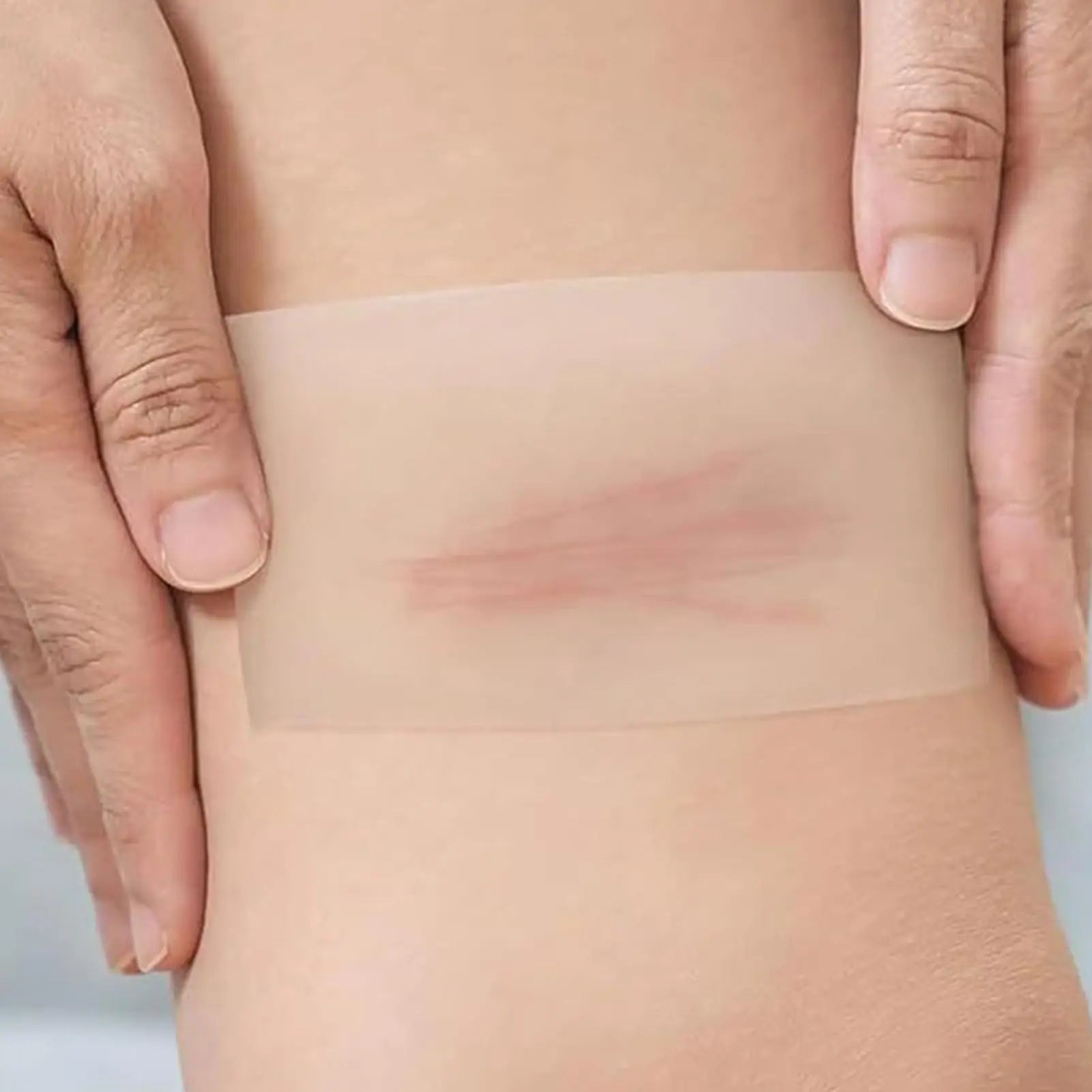 Hydrocolloid Roll Waterproof Pimple Patches Absorbent Flexible Tape Adhesive Dressing for Blister Burn Pimple Skin Heel Daily