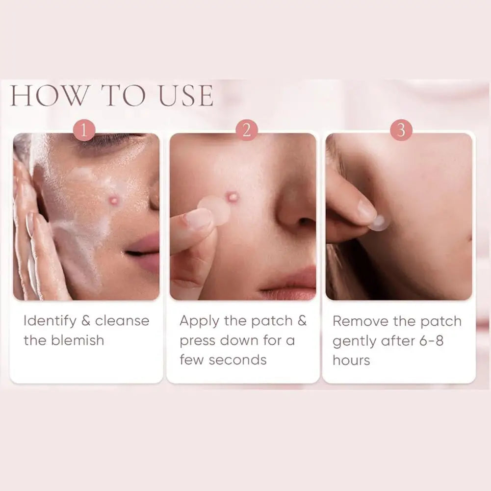 Hydrocolloid Acne Patches Pimple Patches for Face 264pcs Round Shape Spot Stickers Zit Covers for Women